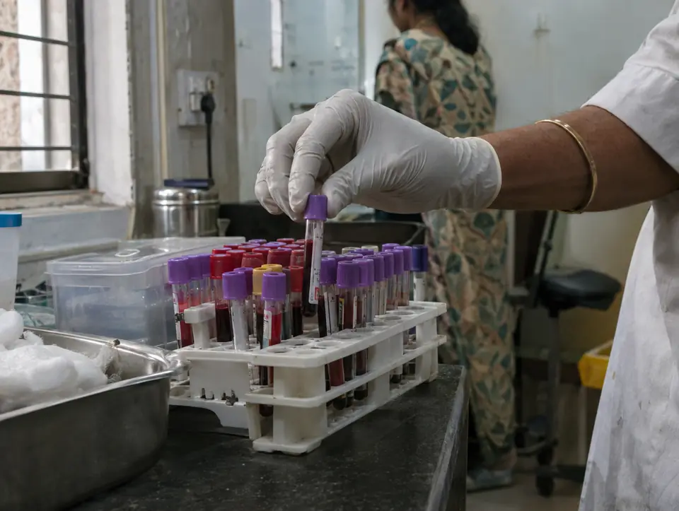 Blood sample tubes in a rack being picked up by a gloved hand